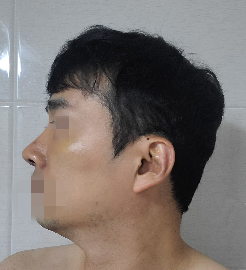 수술후기이미지