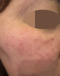 수술후기이미지