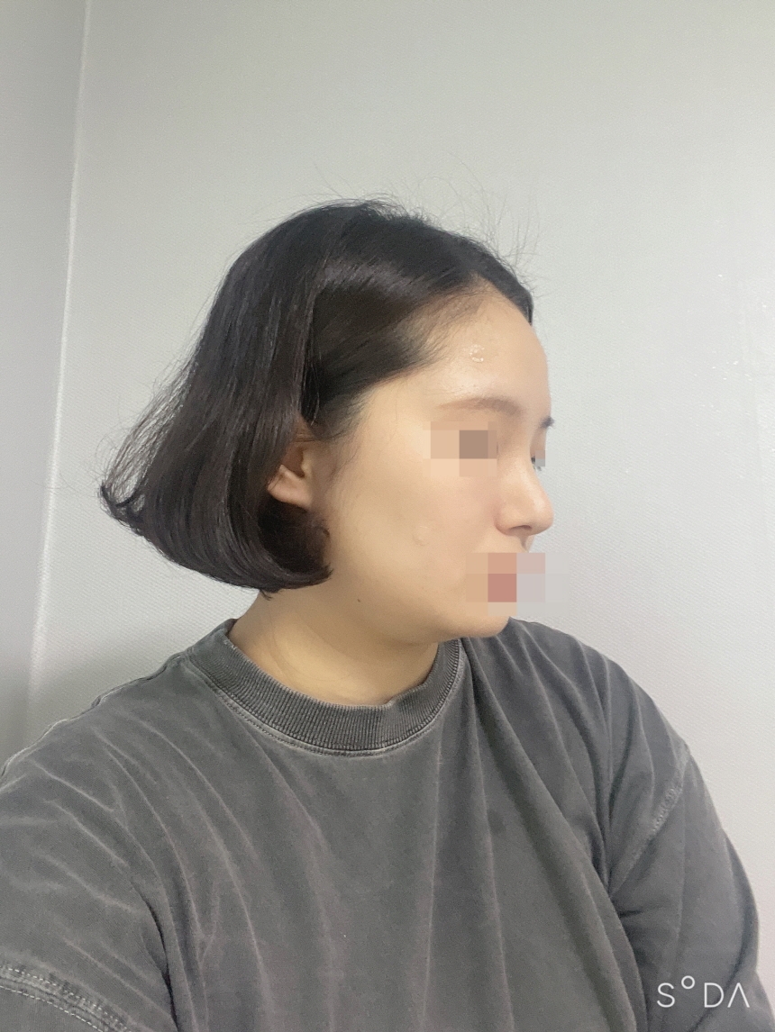 수술후기이미지