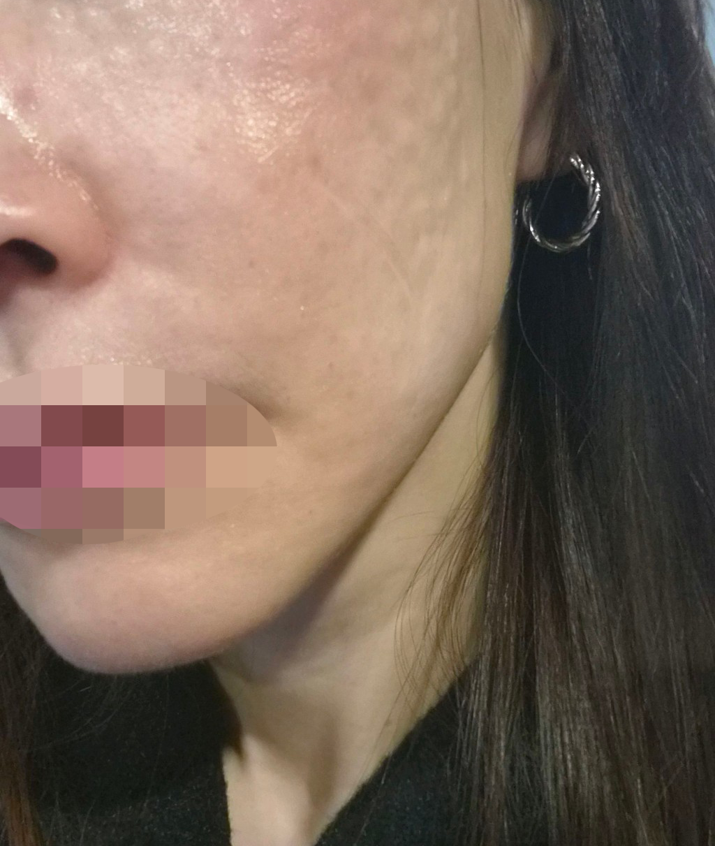 수술후기이미지