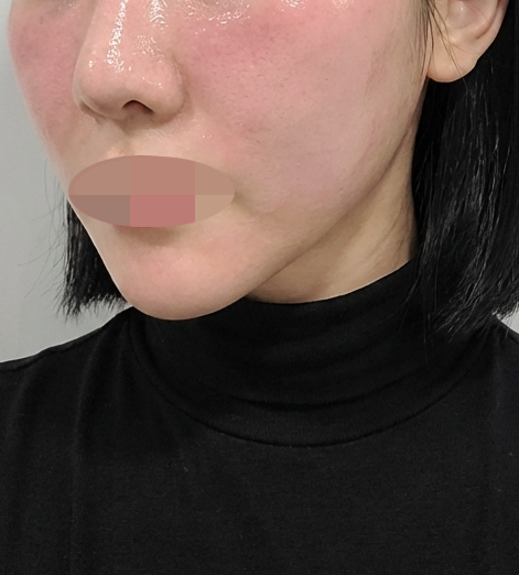 수술후기이미지