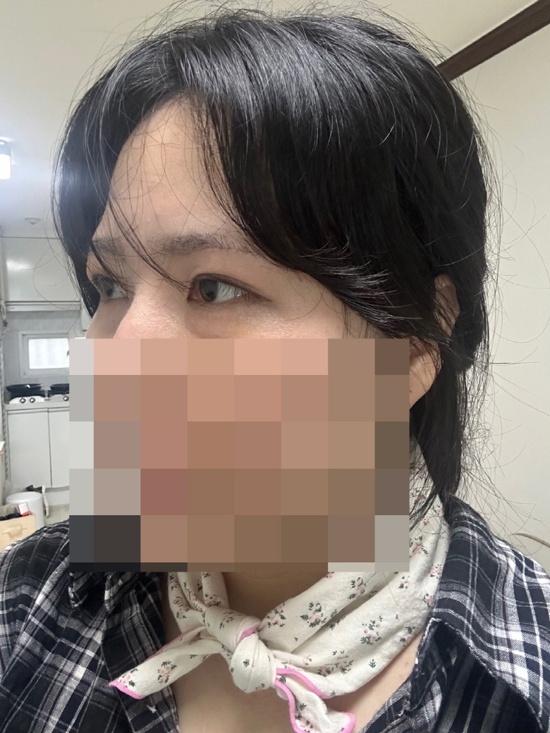 수술후기이미지