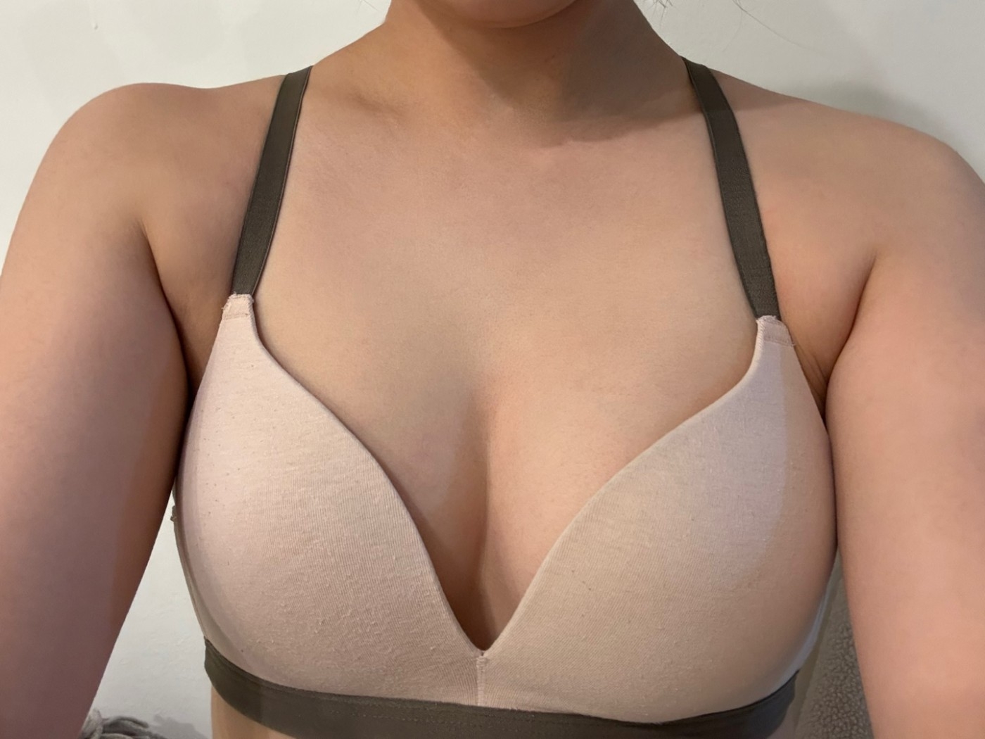 수술후기이미지