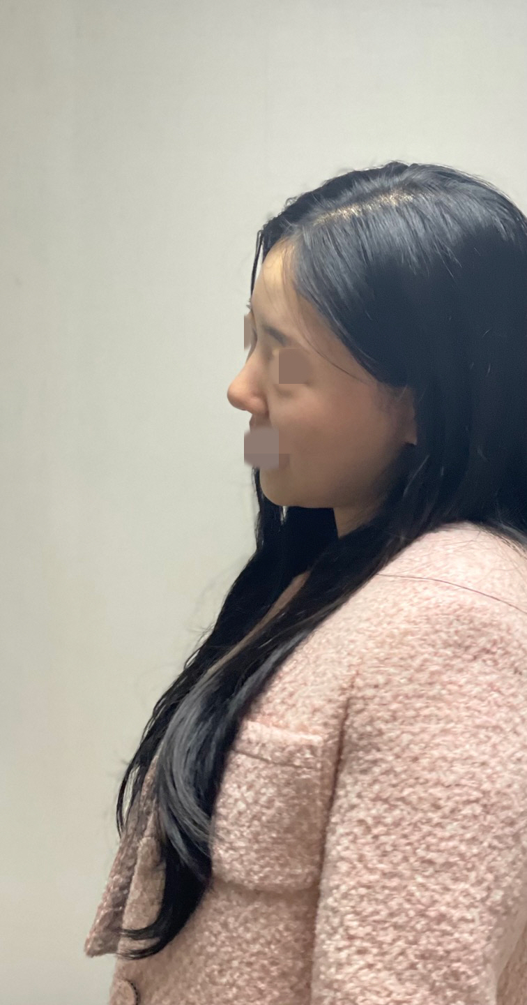 수술후기이미지