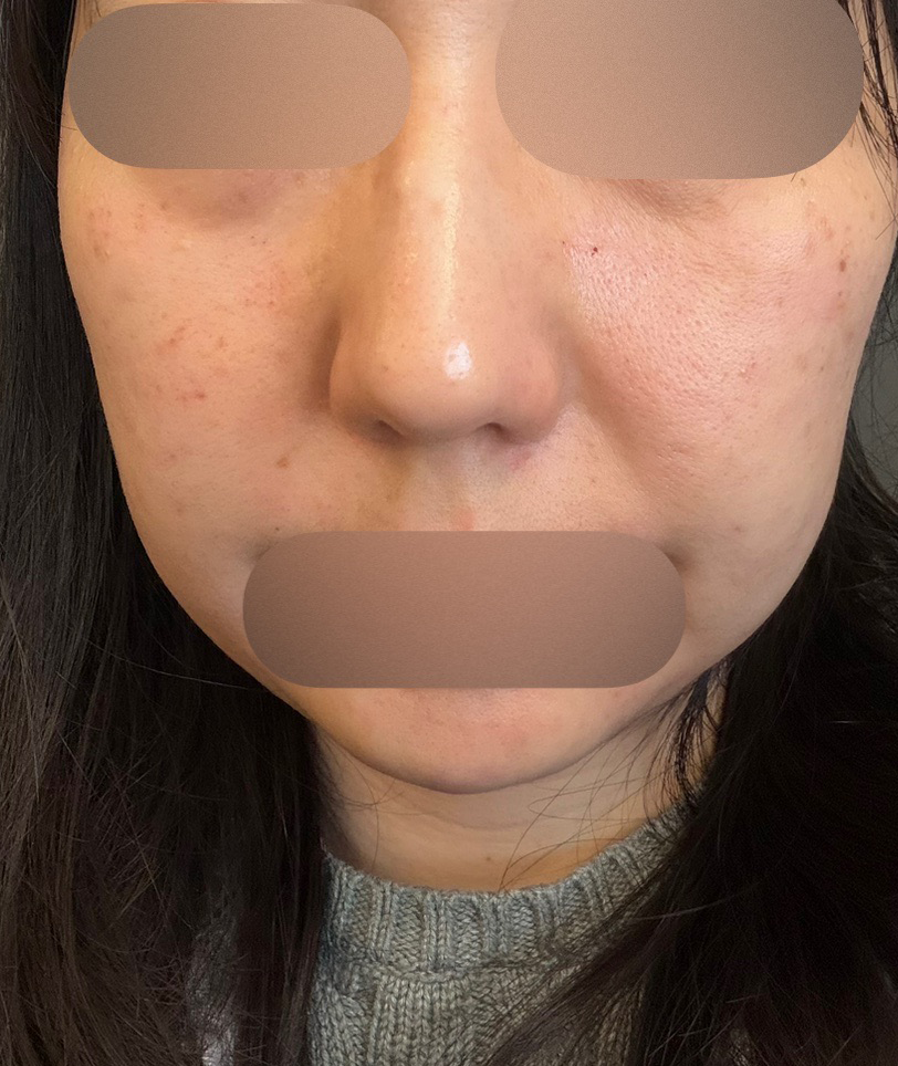 수술후기이미지