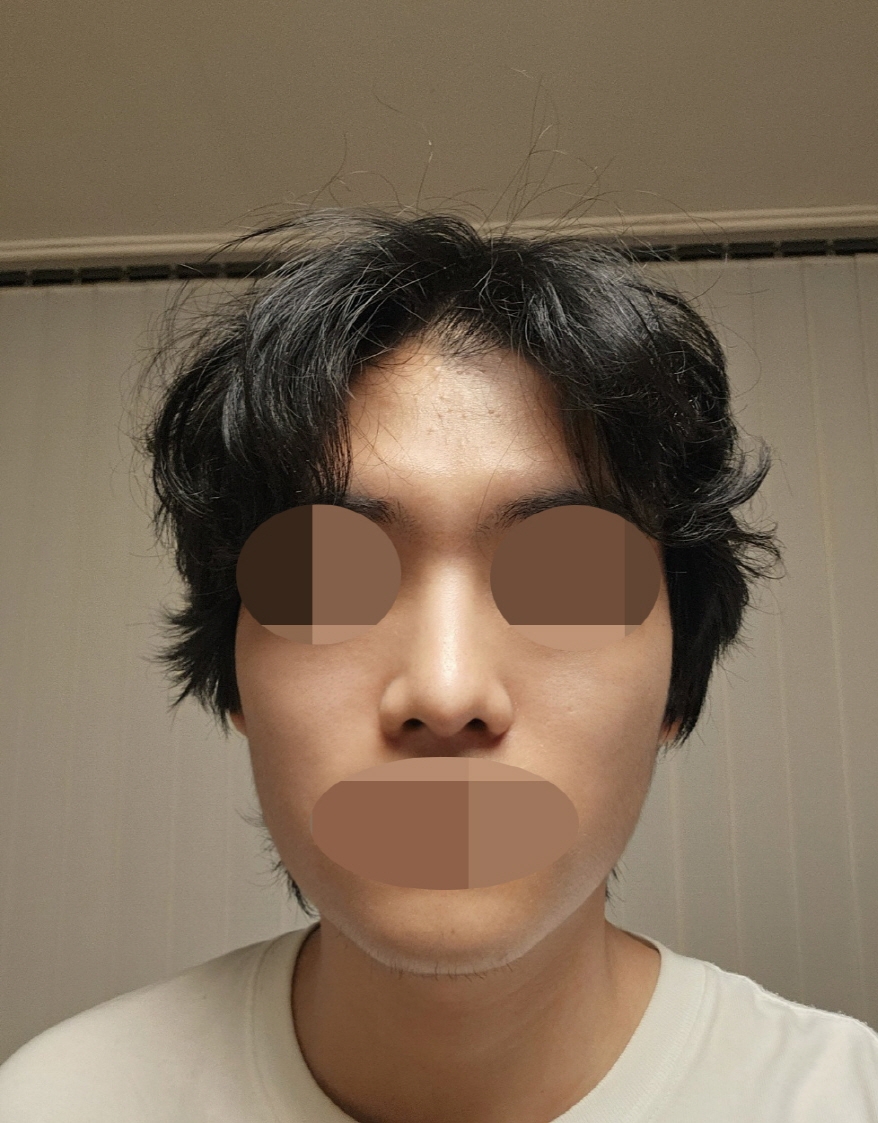 수술후기이미지