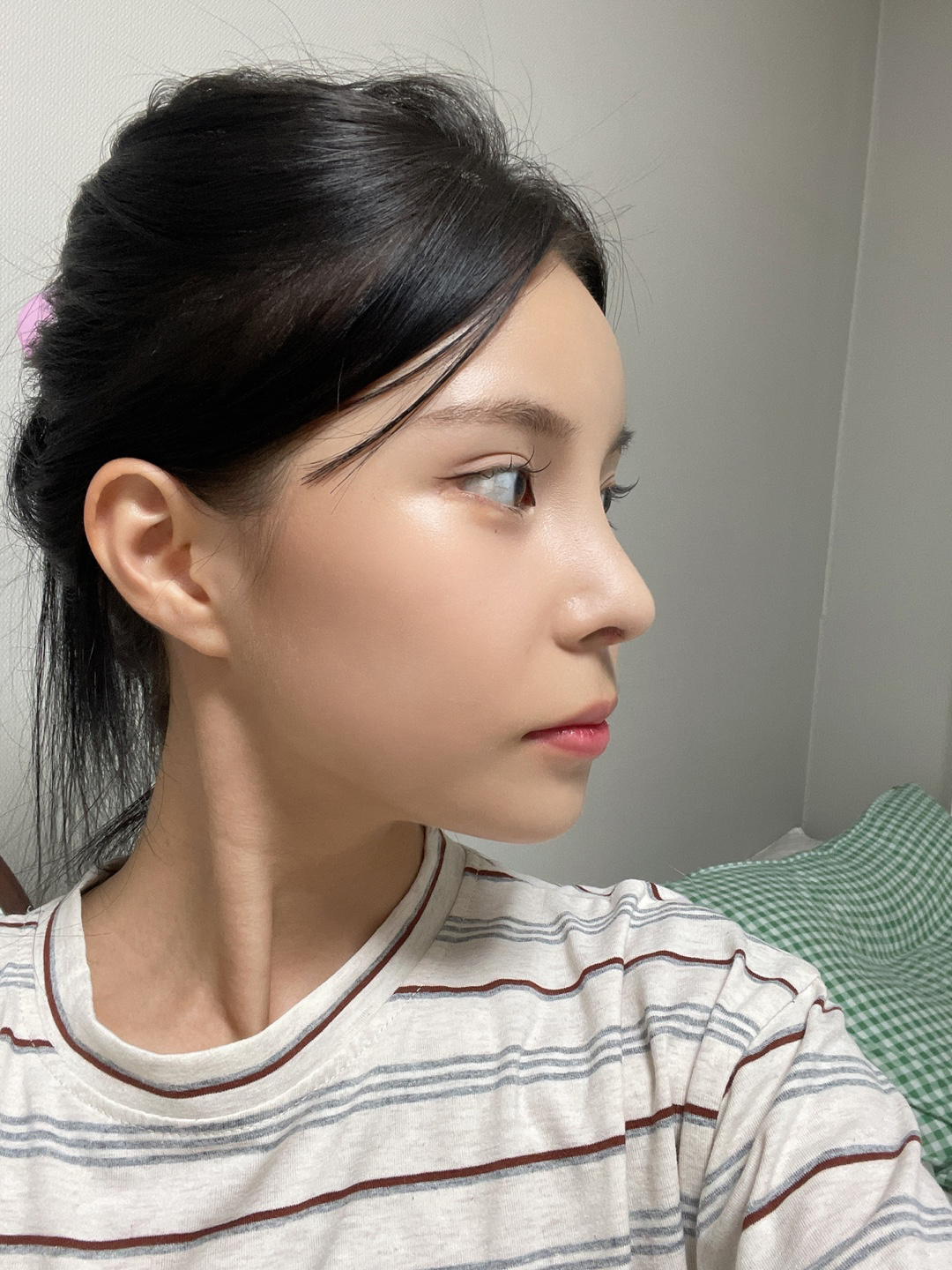 수술후기이미지