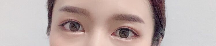 수술후기이미지