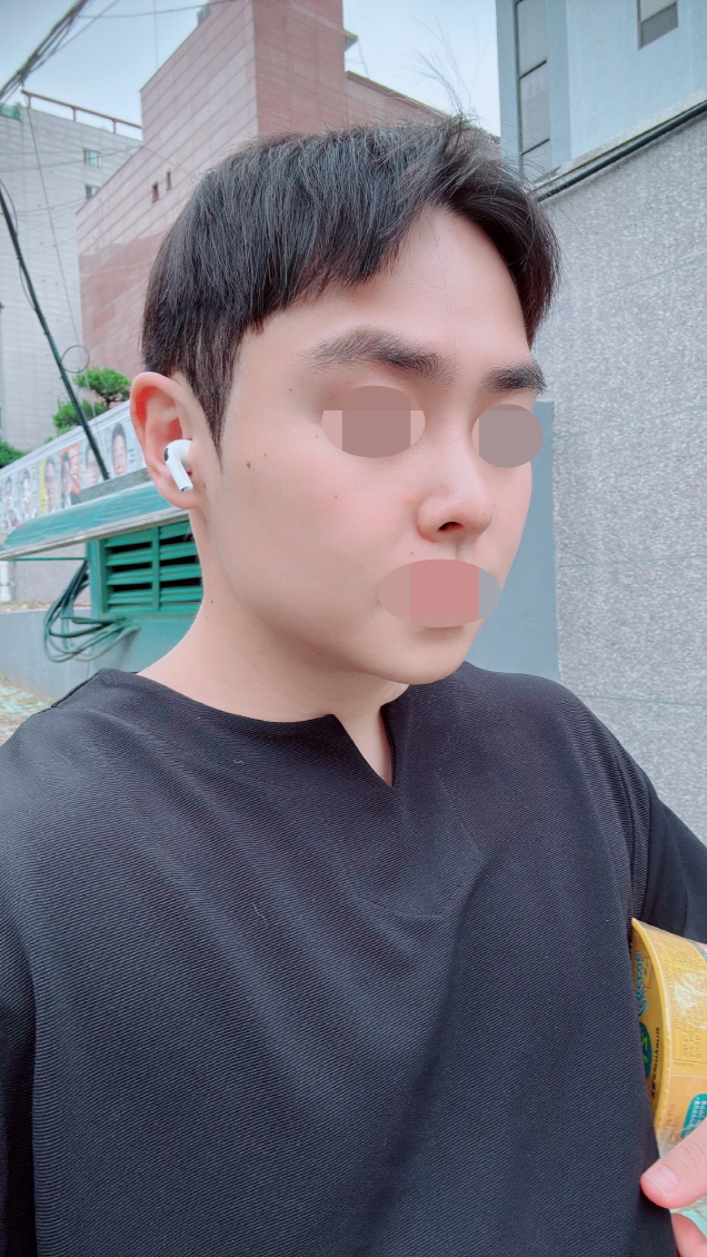 수술후기이미지