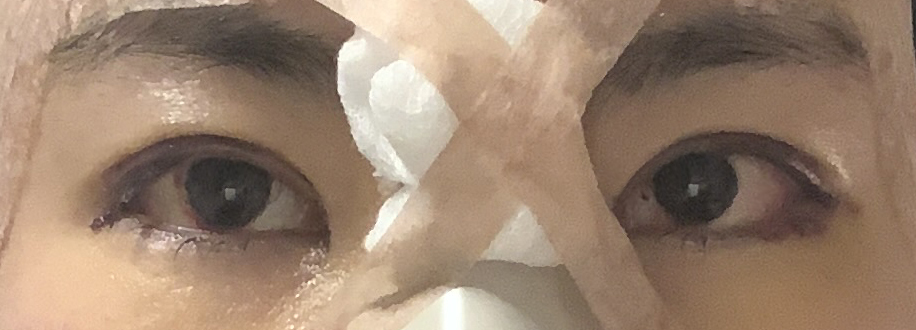 수술후기이미지