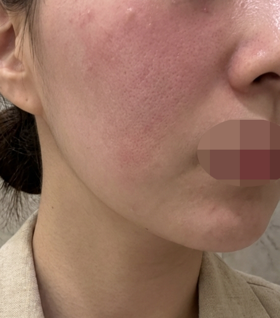 수술후기이미지