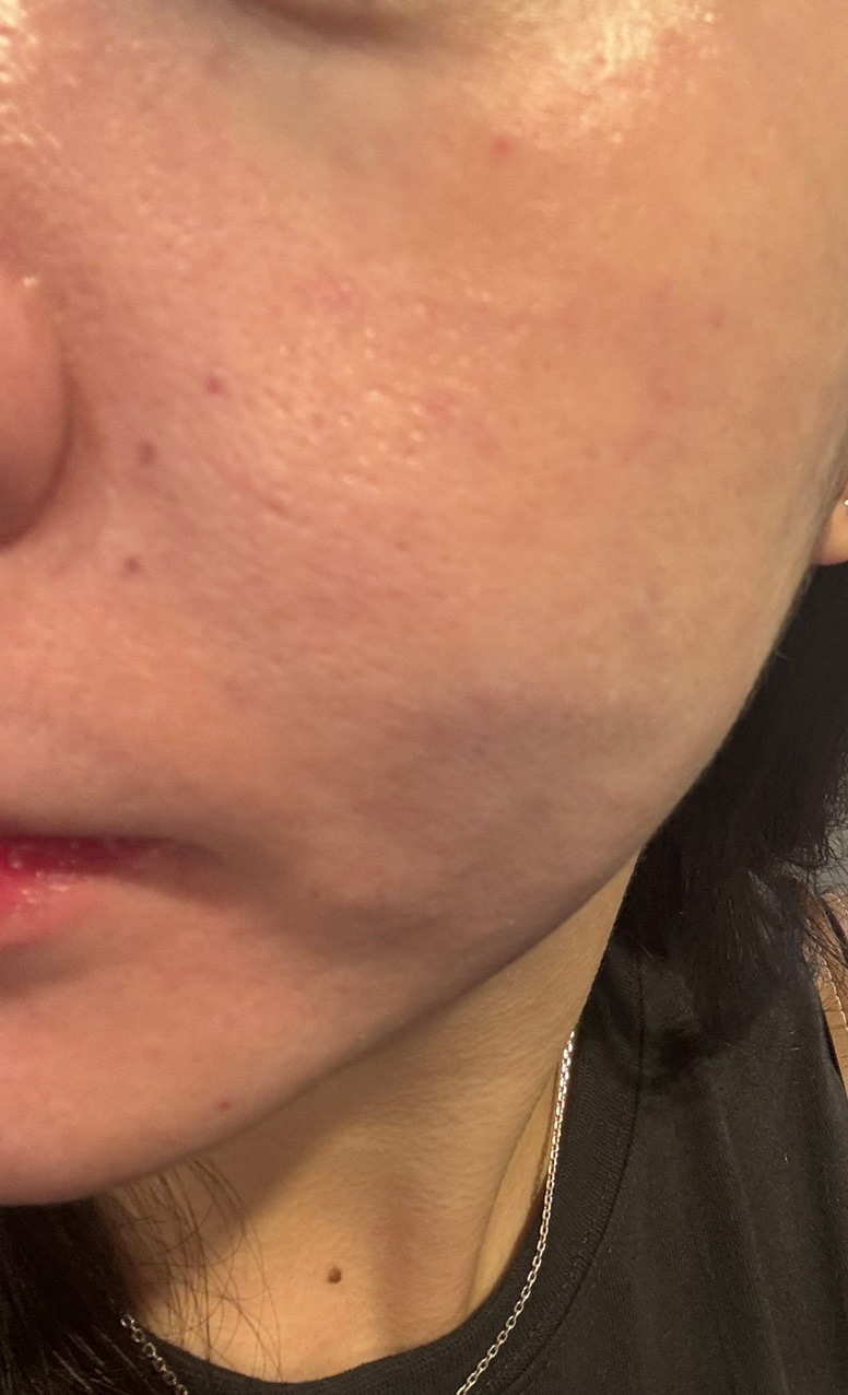 수술후기이미지