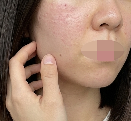 수술후기이미지