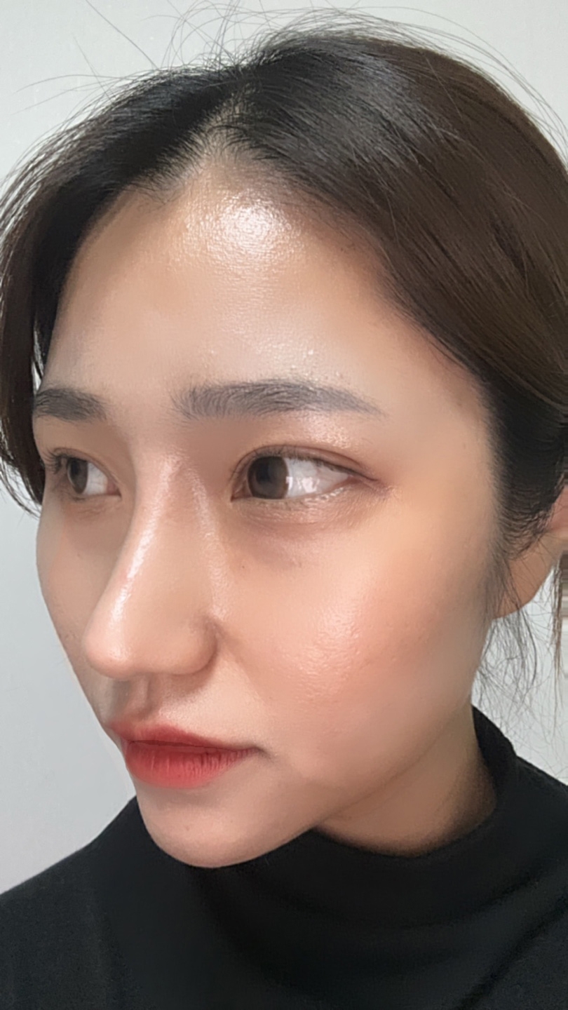 수술후기이미지