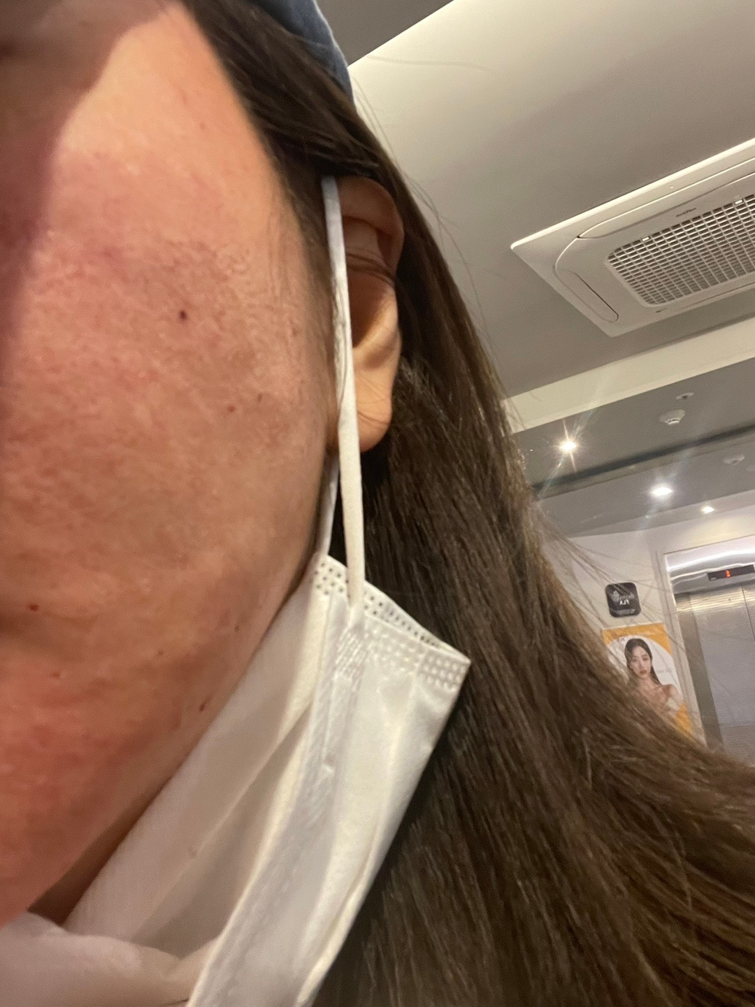 수술후기이미지