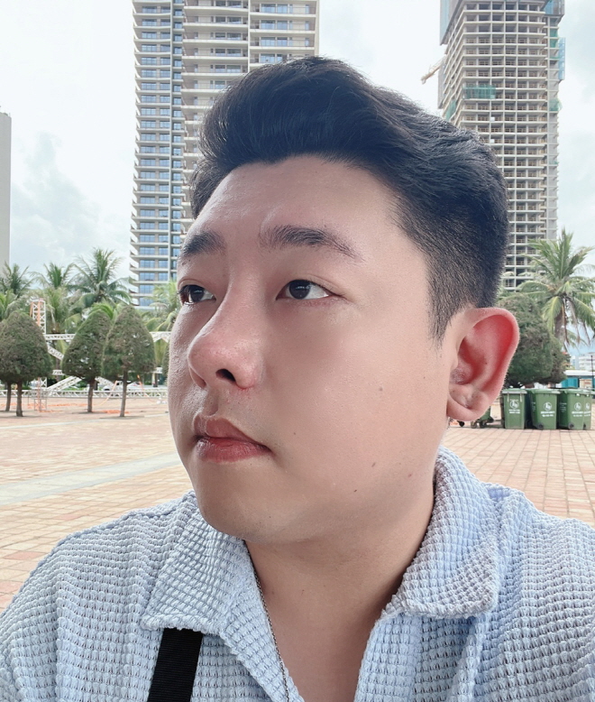 수술후기이미지