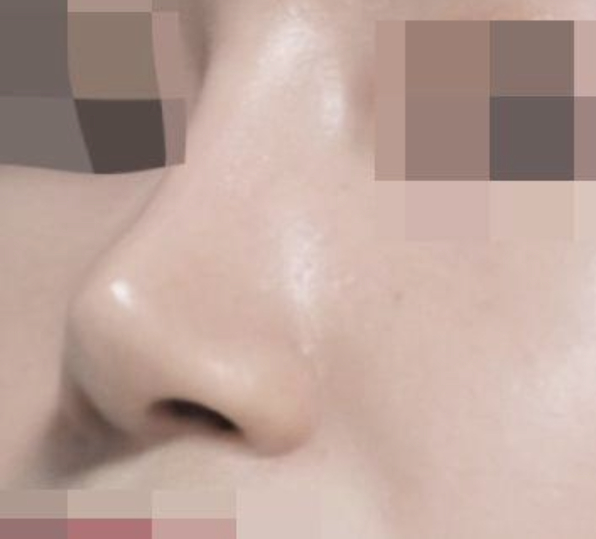 수술후기이미지