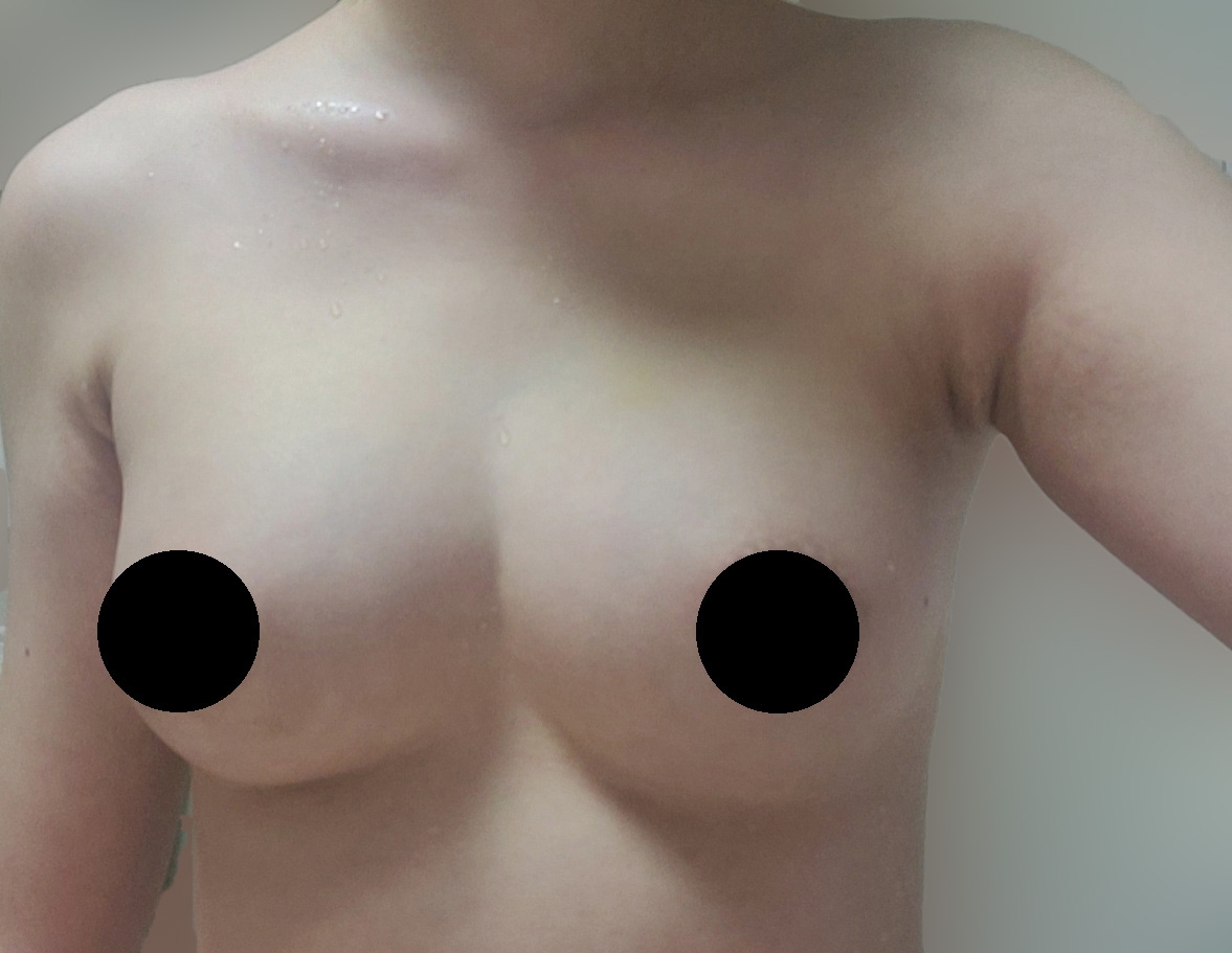 수술후기이미지