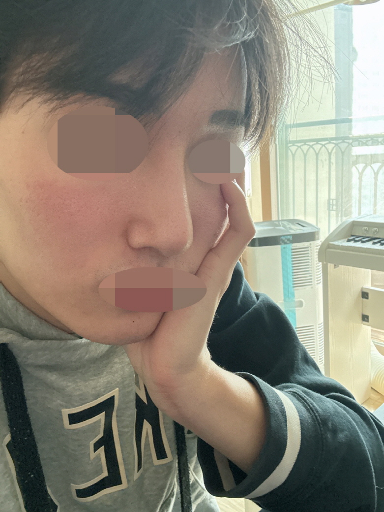 수술후기이미지