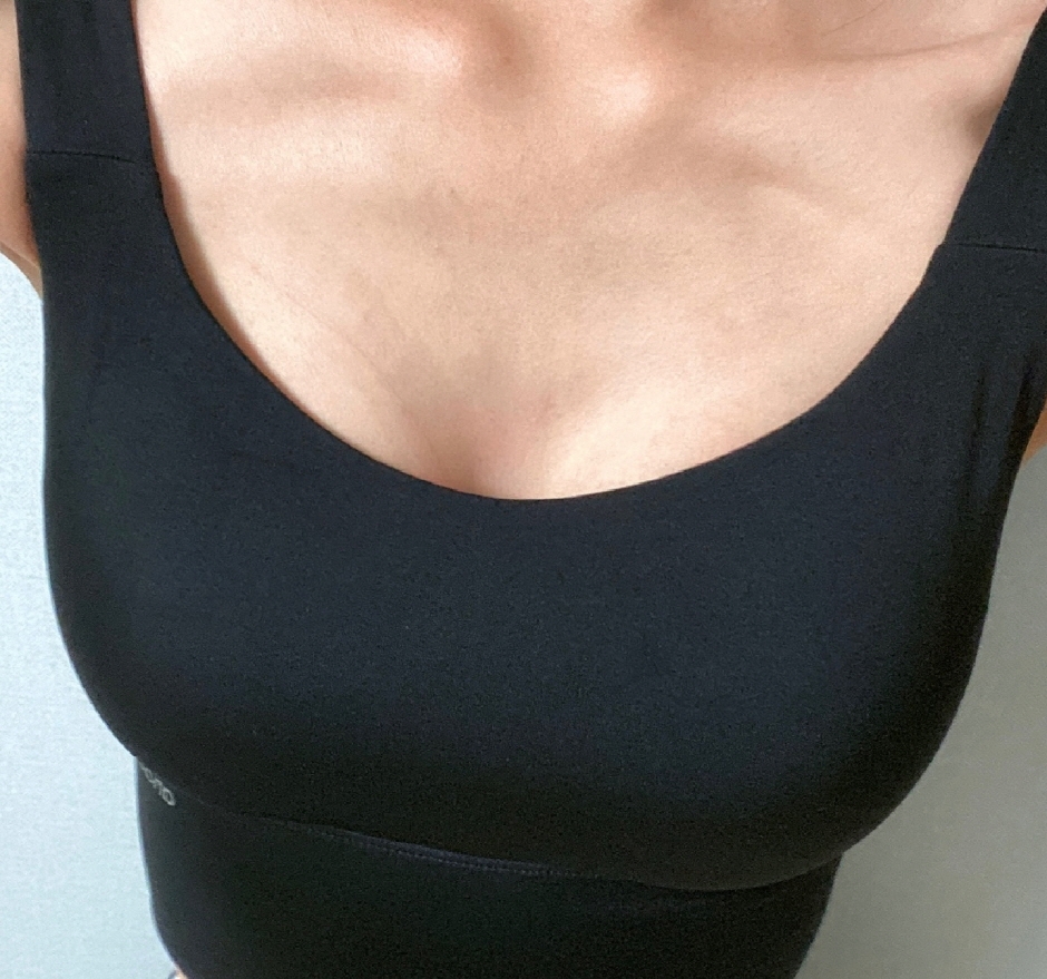 수술후기이미지