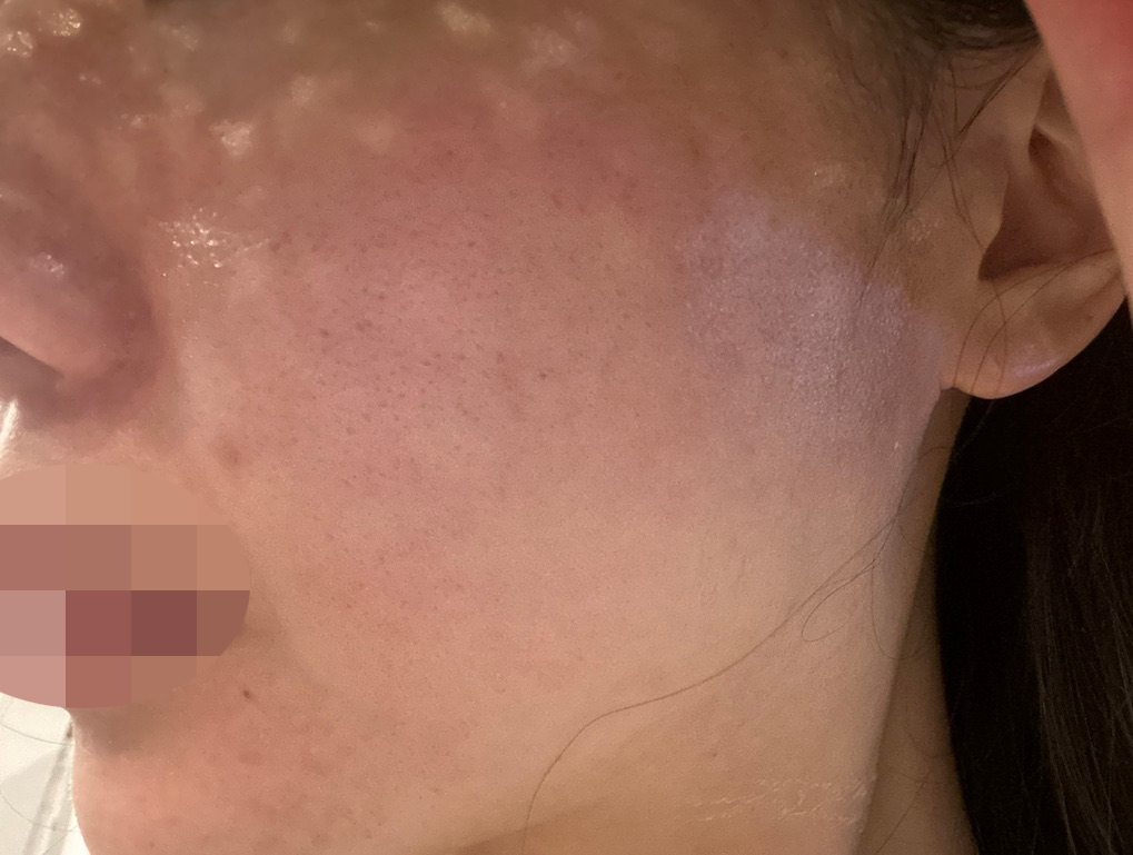 수술후기이미지