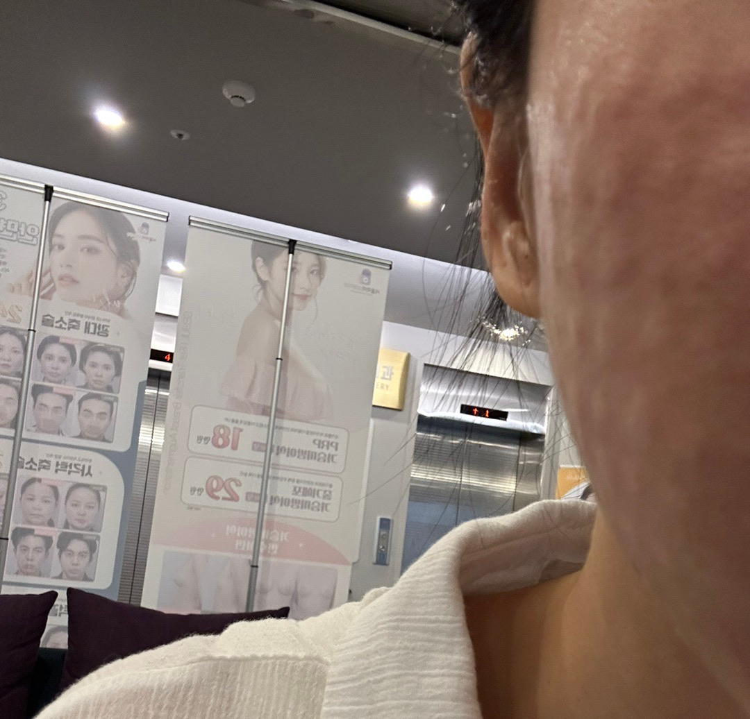 수술후기이미지