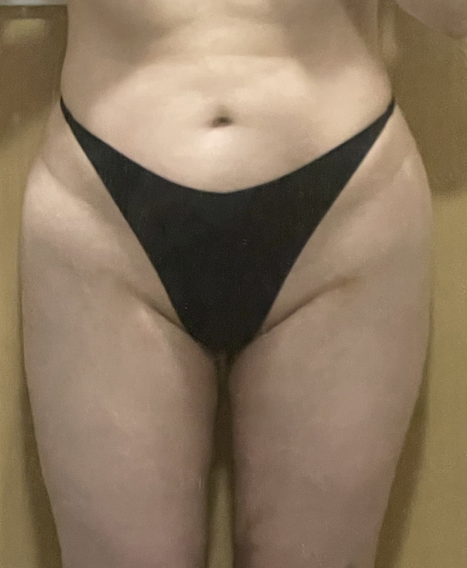 수술후기이미지