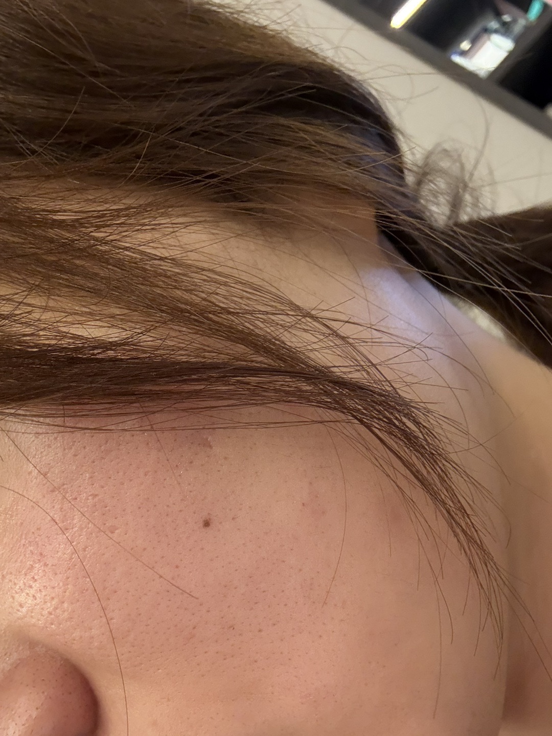 수술후기이미지