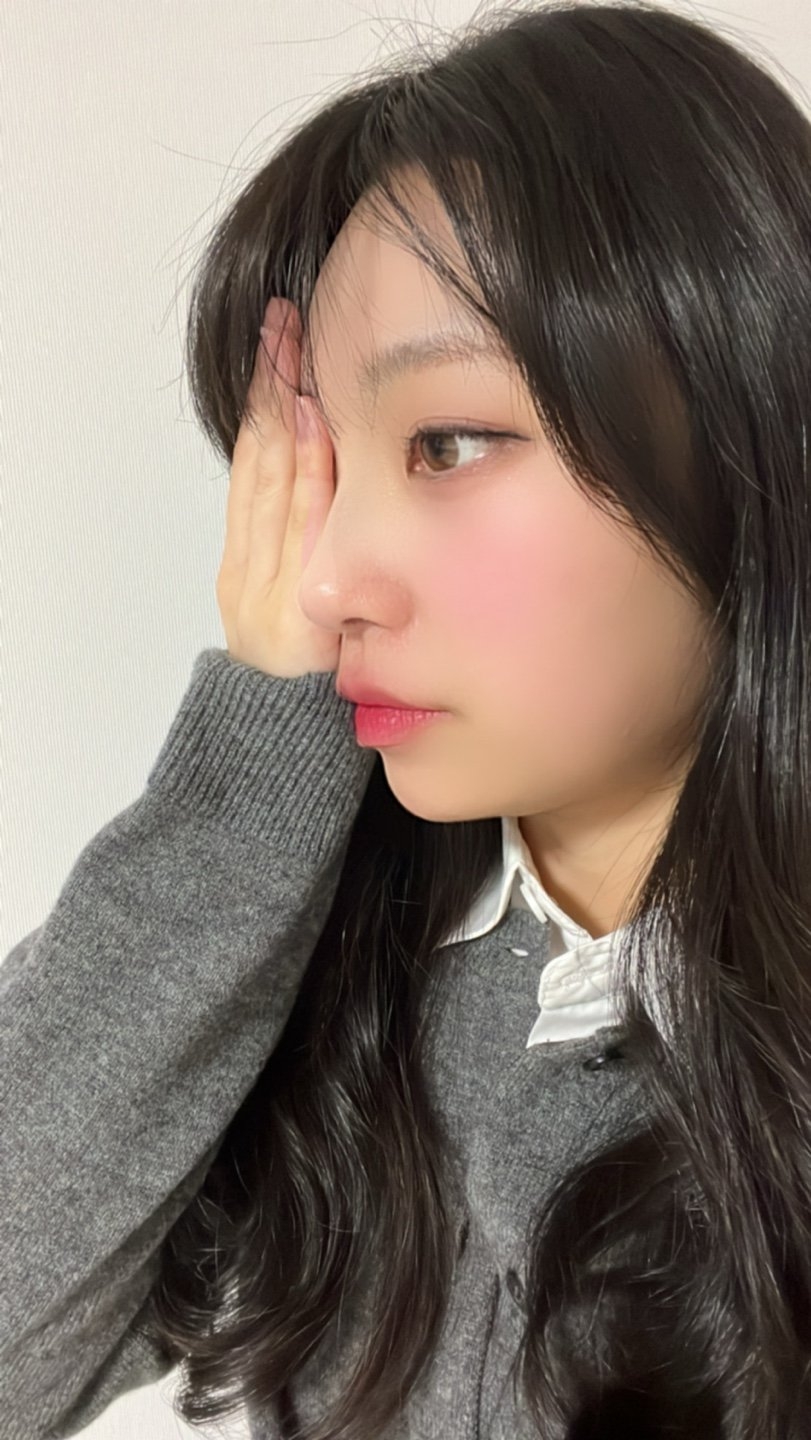 수술후기이미지