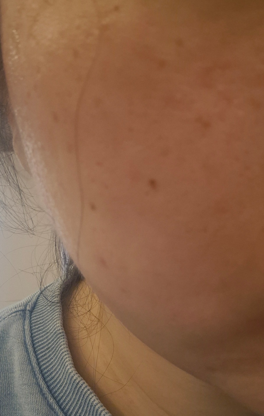 수술후기이미지