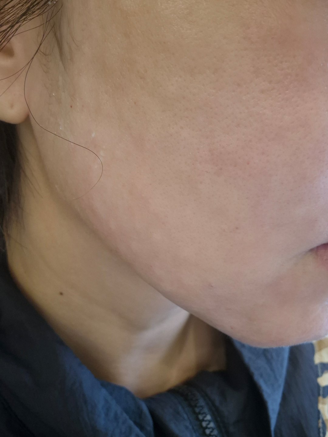 수술후기이미지