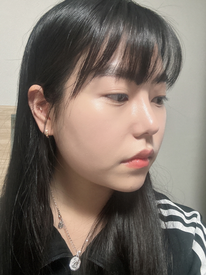 수술후기이미지