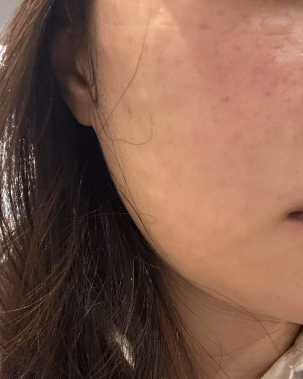 수술후기이미지