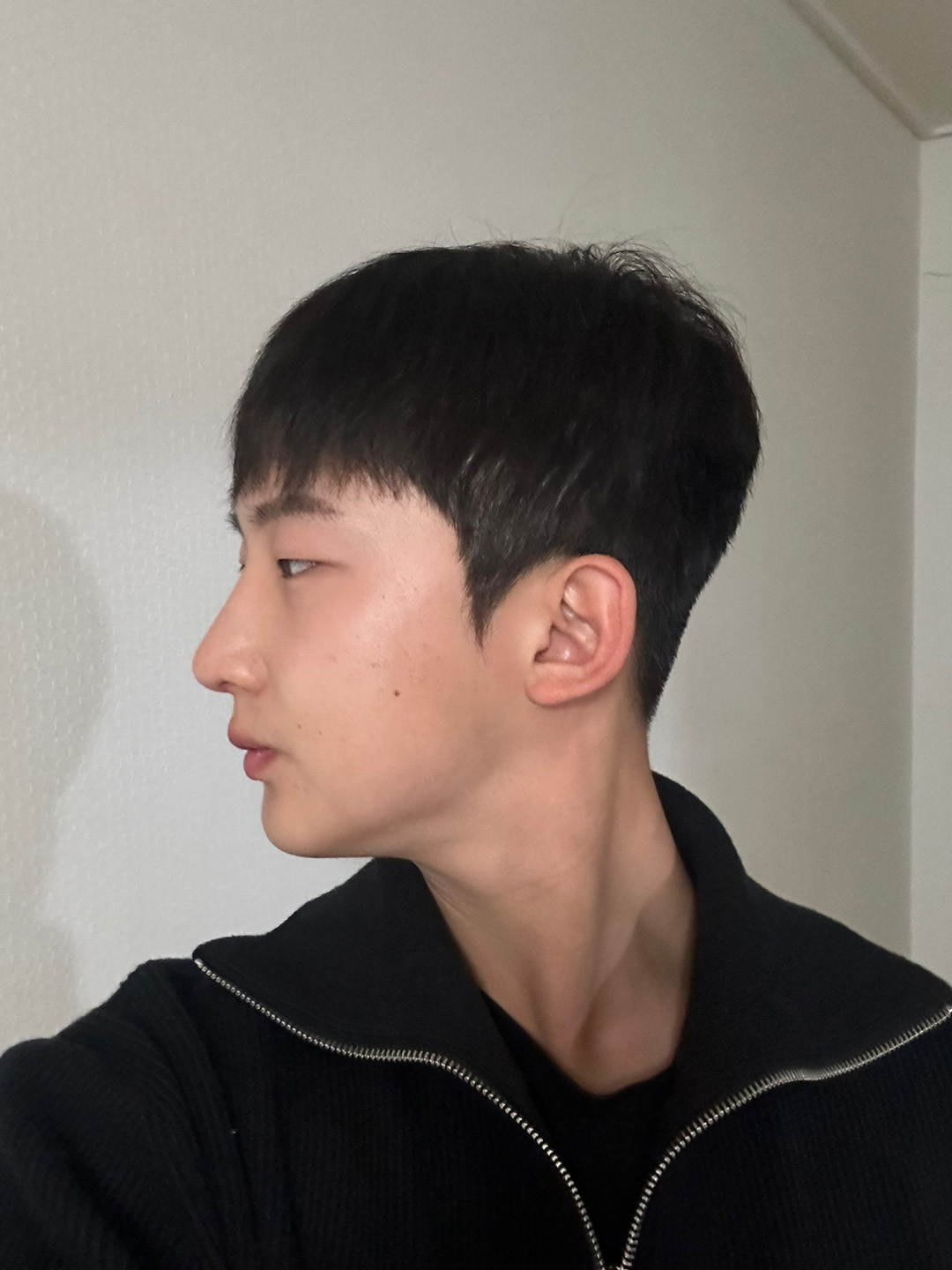 수술후기이미지