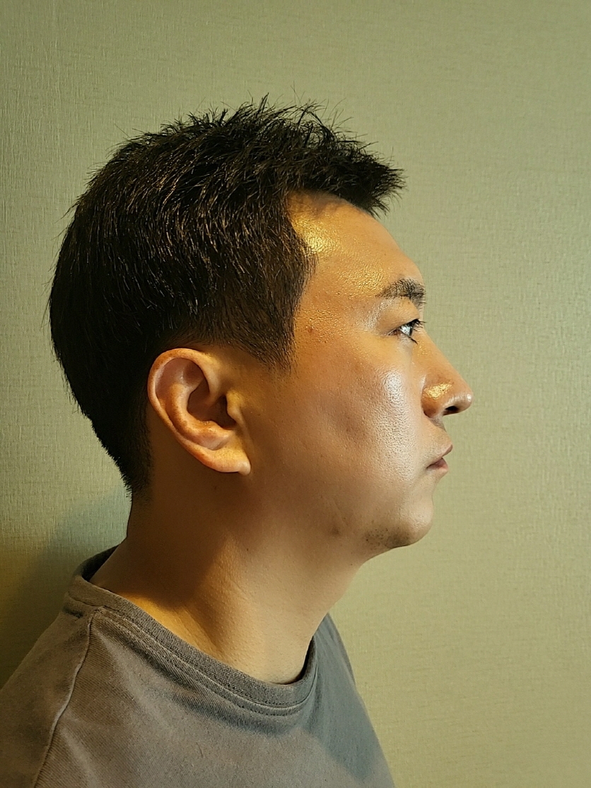 수술후기이미지