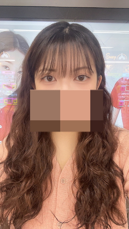 수술후기이미지