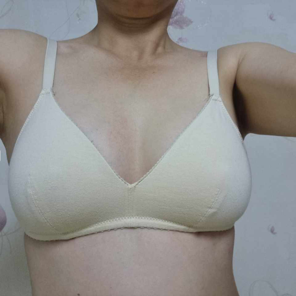 수술후기이미지