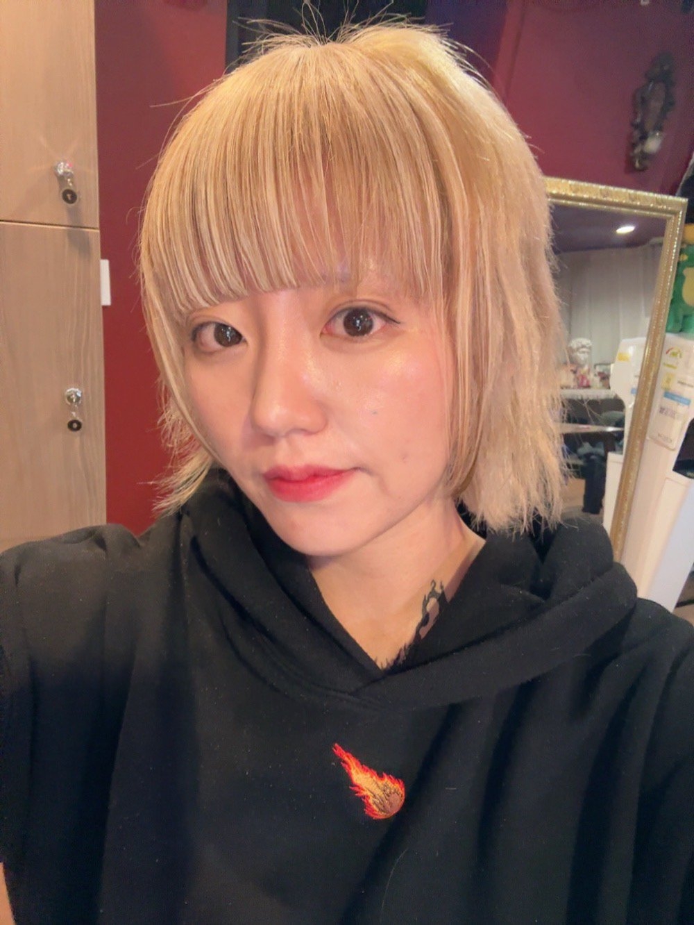 수술후기이미지