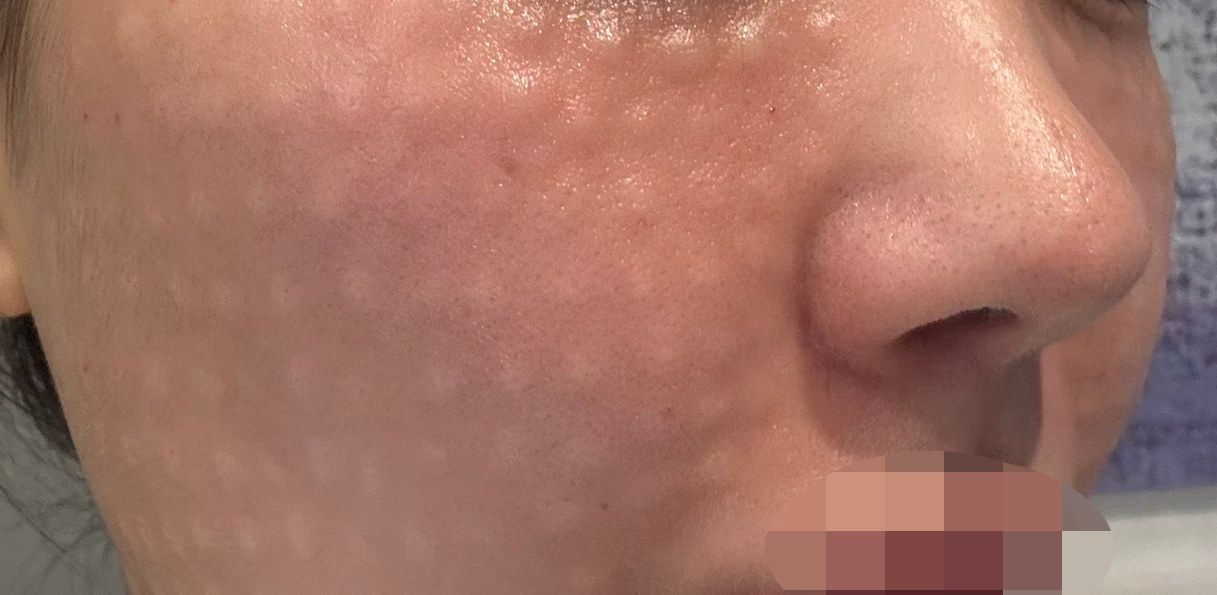 수술후기이미지