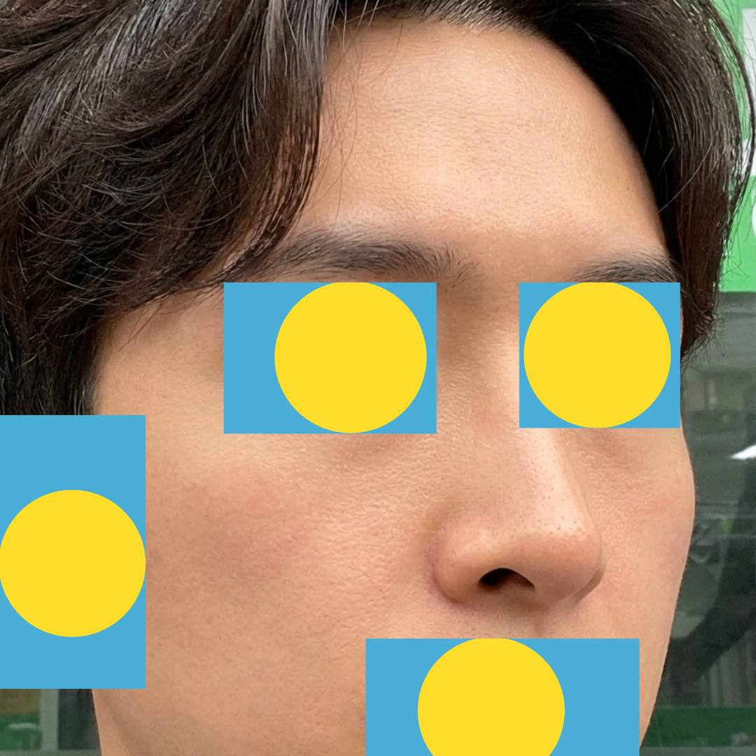 수술후기이미지