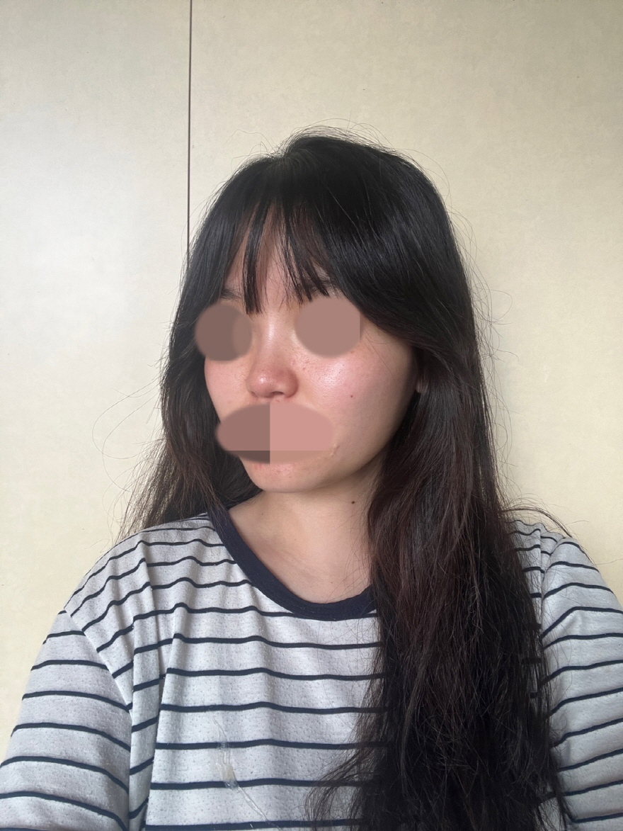 수술후기이미지