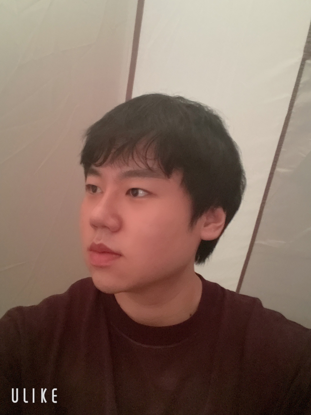 수술후기이미지