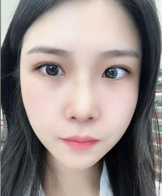 수술후기이미지