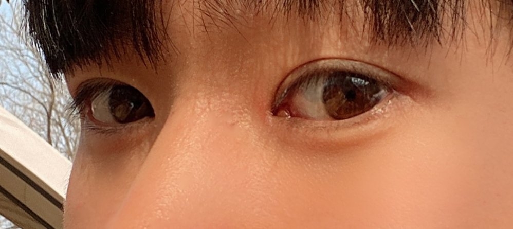 수술후기이미지