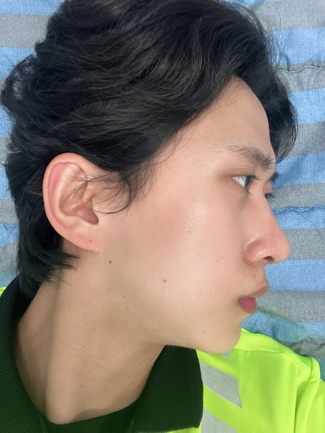 수술후기이미지