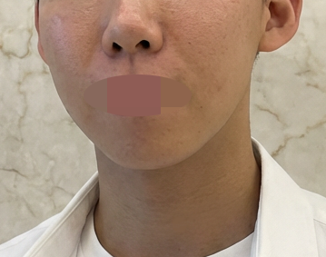 수술후기이미지