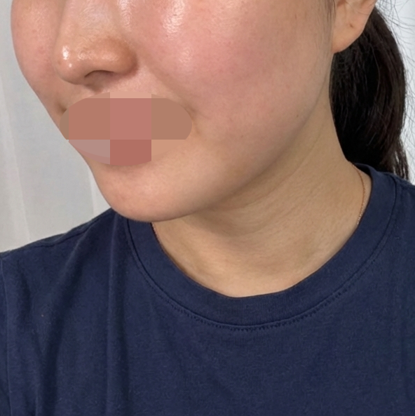 수술후기이미지