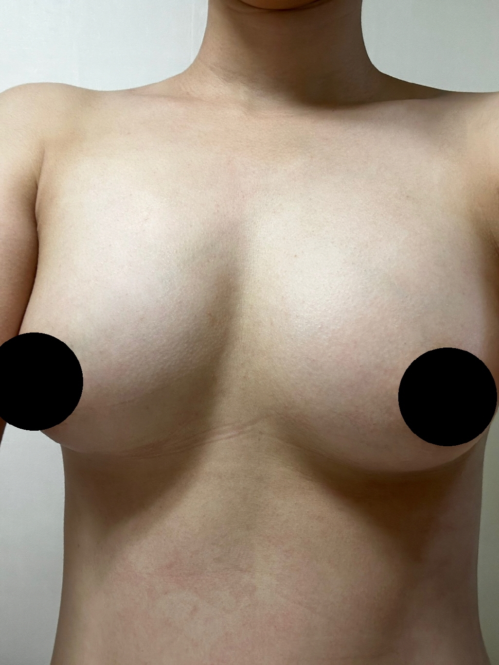 수술후기이미지