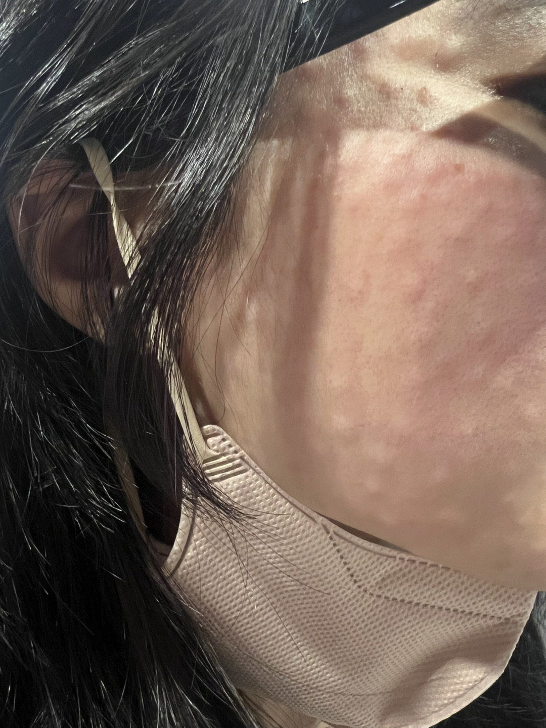 수술후기이미지