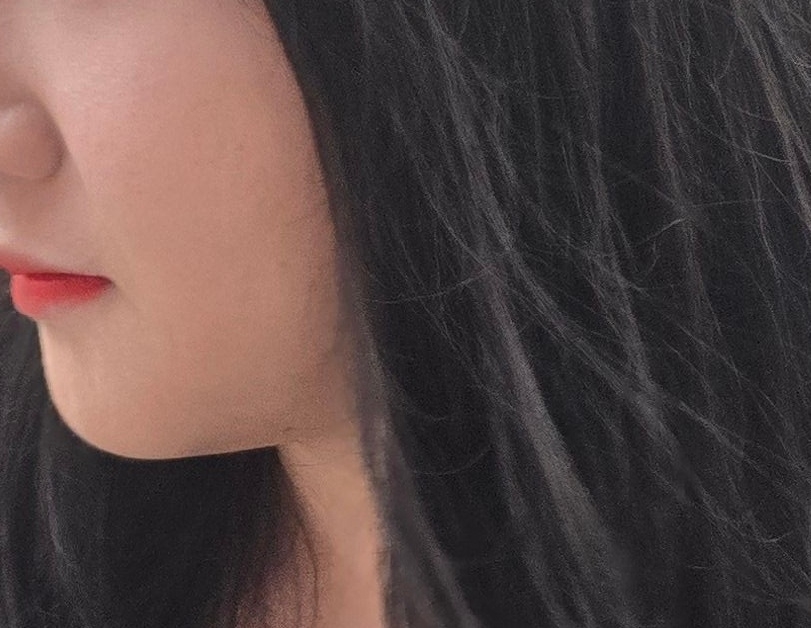 수술후기이미지